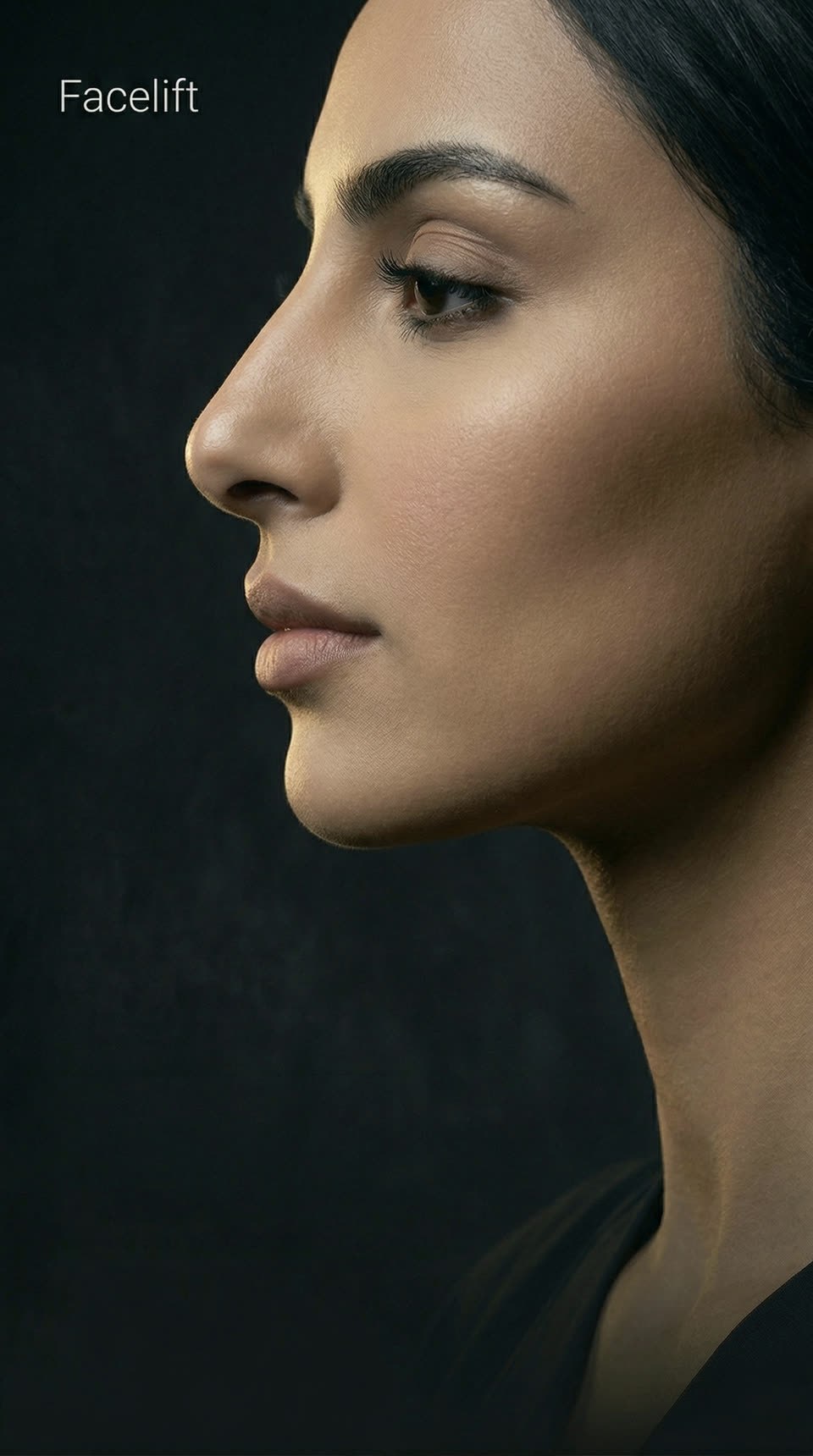 Facelift